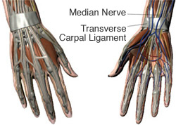 Carpal Tunnel Carpal Tunnel